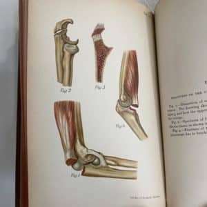On Fractures and Disclocations by Professor Dr. H. Helferich - Image 4