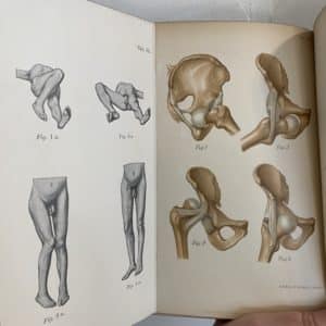 On Fractures and Disclocations by Professor Dr. H. Helferich - Image 3